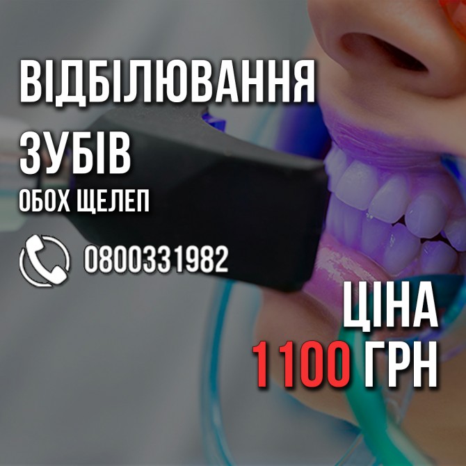 Відбілювання зубів ВСЬОГО 1100 грн. +Поверхнева чистка БЕЗКОШТОВНО. - изображение 1