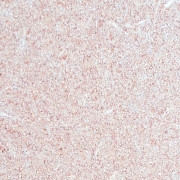 Рідкі шпалери термостійкі