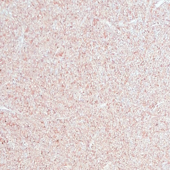 Рідкі шпалери термостійкі - изображение 1